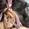 ear piercing procedure