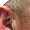 male migraine patients ear piercing