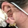 gold rings for ear piercing patients