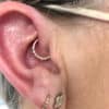 anxiety solution at daith