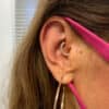 anxiety solution with ear piercing