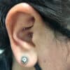 ear piercing for female migraine patients