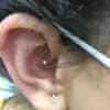 daith anxiety solutions for ladies