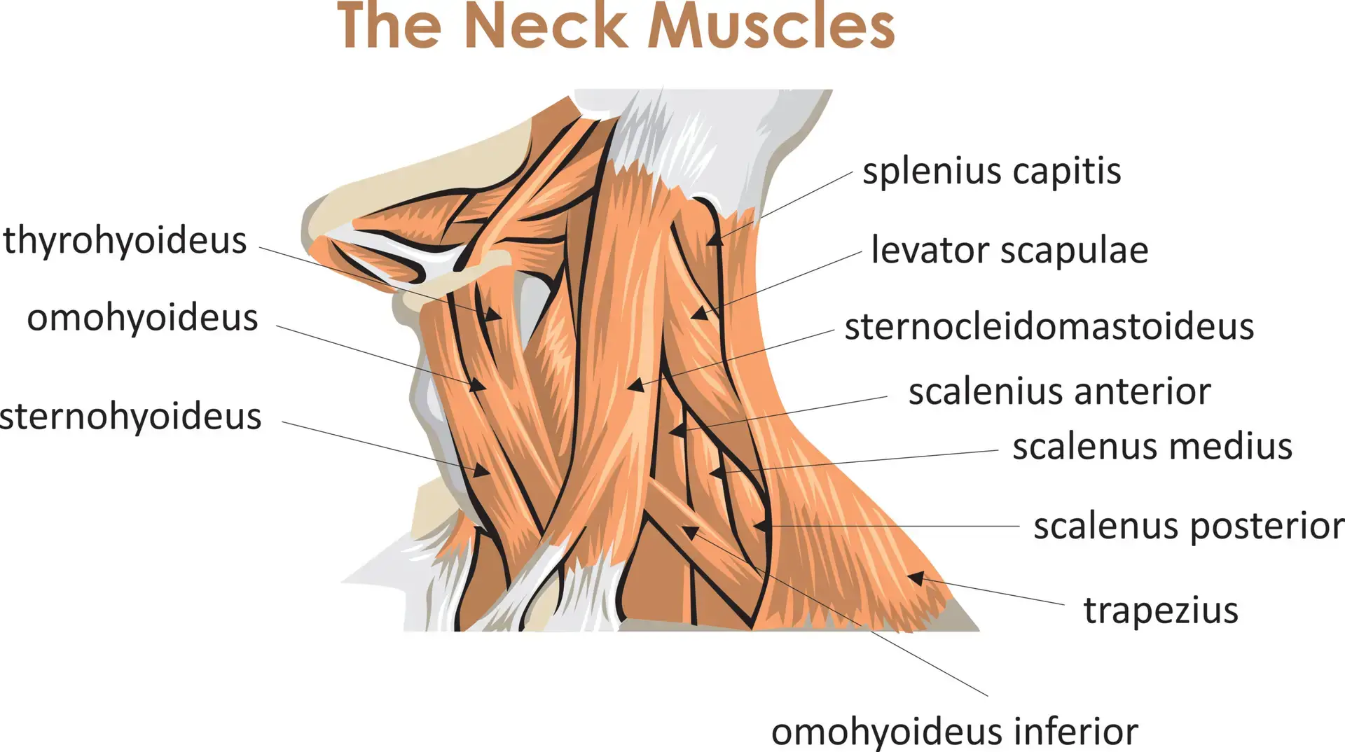 Muscles causing migraines