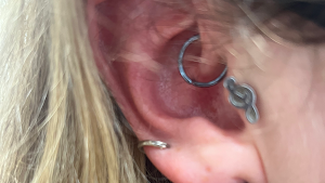 Daith Piercing For Migraine Clinic (Daith Medical Ltd)