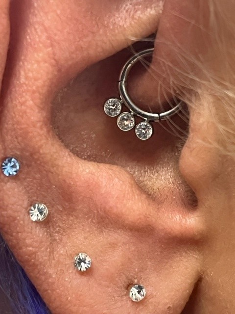 re-stimulation of daith piercings